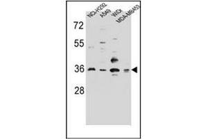 Western blot analysis of RIC3 Antibody (C-term) in NCI-H292,A549,WiDr,MDA-MB453 cell line lysates (35ug/lane). (RIC3 anticorps  (C-Term))