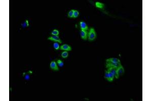 Immunofluorescence staining of HepG2 cells with ABIN7159436 at 1:66, counter-stained with DAPI.