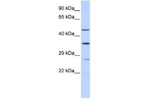 WB Suggested Anti-MEF2B Antibody Titration:  0. (MEF2B anticorps  (N-Term))