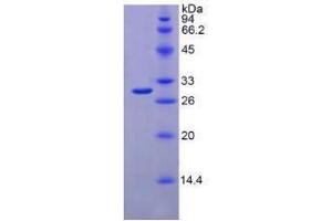 SDS-PAGE analysis of Mouse IFNa/bR1 Protein. (IFNAR1 Protéine)