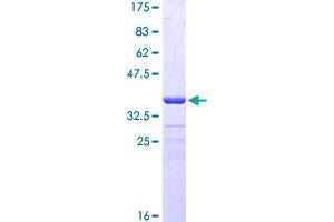 Image no. 1 for Proline Dehydrogenase (Oxidase) 1 (PRODH) (AA 441-540) protein (GST tag) (ABIN1316362)