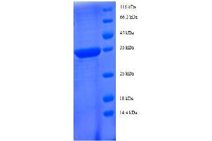 Chemokine (C-C Motif) Ligand 5 (CCL5) (AA 24-91), (full length) protein (GST tag)