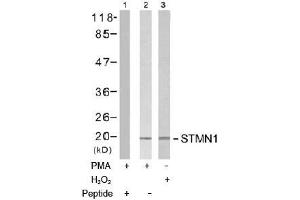 Image no. 2 for anti-Stathmin 1 (STMN1) (Ser15) antibody (ABIN197474) (Stathmin 1 anticorps  (Ser15))