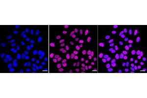 Immunocytochemical staining of HepG2 cells with RBBP4 antibody (ABIN7800185), 1:1,000). (Recombinant Retinoblastoma Binding Protein 4 anticorps)
