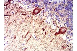 Immunohistochemical analysis of paraffin-embedded cerebellum tissues using RAB27B mouse mAb with DAB staining. (RAB27B anticorps  (AA 2-218))