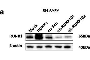 RUNX1 suppresses the growth, migration, invasion and angiogenesis of NB cells in vitro.