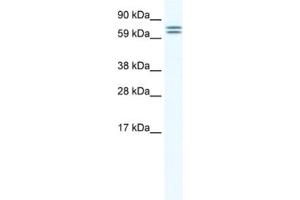 Western Blotting (WB) image for anti-Carboxylesterase 4A (CES4A) antibody (ABIN2461535) (CES4A anticorps)