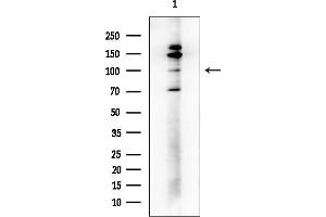 anti-Splicing Factor, Suppressor of White-Apricot Homolog (SFSWAP) (N-Term) antibody