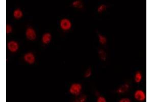 ABIN6266869 staining LOVO by IF/ICC. (TRIP13 anticorps  (C-Term))