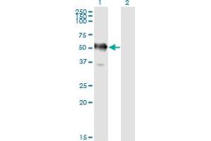 Western Blot analysis of GAPDHS expression in transfected 293T cell line by GAPDS monoclonal antibody (M01), clone 2E3-2E10. (GAPDHS anticorps  (AA 1-408))