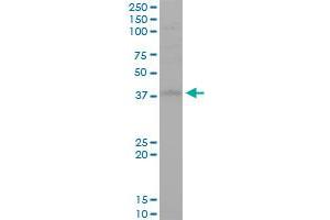 STYK1 monoclonal antibody (M02), clone 3D2.