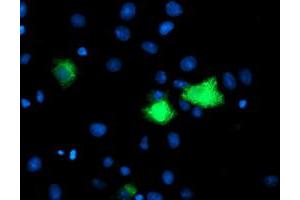 Image no. 1 for anti-Carboxypeptidase A1 (Pancreatic) (CPA1) antibody (ABIN1497591) (CPA1 anticorps)