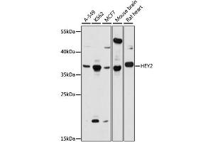 Western blot analysis of extracts of various cell lines, using HEY2 antibody (ABIN6294032) at 1:1000 dilution. (HEY2 anticorps)