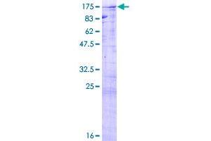 Image no. 1 for CDC5 Cell Division Cycle 5-Like (S. Pombe) (CDC5L) (AA 1-802) protein (GST tag) (ABIN7595955)