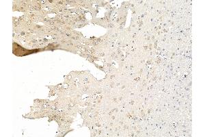 ABIN7094752 and ABIN7098803 at 1/100 staining Rat brain tissue by IHC-P. (NMNAT2 anticorps  (C-Term))