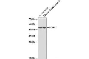 Western blot analysis of extracts of various cell lines using PDHA1 Polyclonal Antibody at dilution of 1:1000. (PDHA1 anticorps)