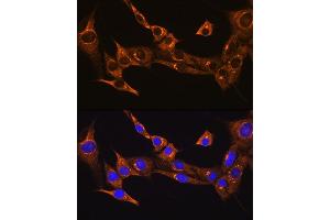 Immunofluorescence analysis of NIH/3T3 cells using BDKRB2 Rabbit pAb (ABIN3016822, ABIN3016823, ABIN3016824 and ABIN6219849) at dilution of 1:100.