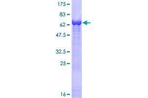 Image no. 1 for Plasminogen Activator Inhibitor 2 (SERPINB2) (AA 1-415) protein (GST tag) (ABIN1319612)