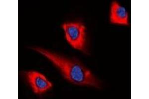 Immunofluorescent analysis of PEA15 staining in HEK293T cells.