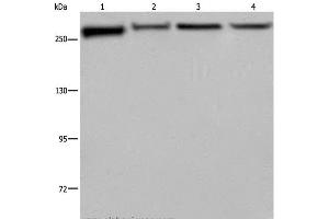 Western Blot analysis of PC3, Hela, NIH/3T3 and HUVEC cell using FLNA Polyclonal Antibody at dilution of 1:800 (Filamin A anticorps)