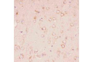 Anti-Tuberin Picoband antibody, IHC(P): Mouse Brain Tissue