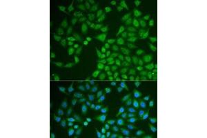 Immunofluorescence analysis of U2OS cells using PNLIP Polyclonal Antibody (PNLIP anticorps)