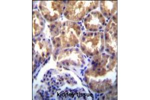TRPM6(CHAK2) Antibody immunohistochemistry analysis in formalin fixed and paraffin embedded human kidney tissue followed by peroxidase conjugation of the secondary antibody and DAB staining. (TRPM6 anticorps  (AA 317-348))