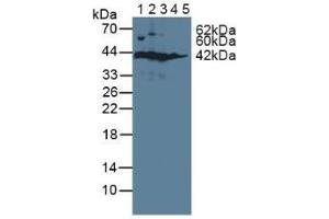 Figure. (SORD anticorps  (AA 2-357))