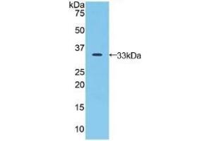 Detection of Recombinant JAG2, Human using Polyclonal Antibody to Jagged 2 Protein (JAG2) (JAG2 anticorps  (AA 714-981))