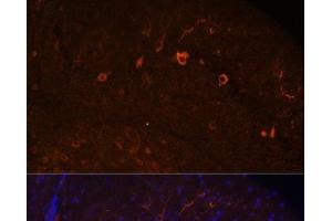 Immunofluorescence analysis of Mouse brain using KAL1 Polyclonal Antibody at dilution of 1:100.