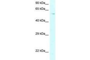 Image no. 1 for anti-Prolyl 4-Hydroxylase, alpha Polypeptide II (P4HA2) (AA 289-338) antibody (ABIN6747697) (P4HA2 anticorps  (AA 289-338))