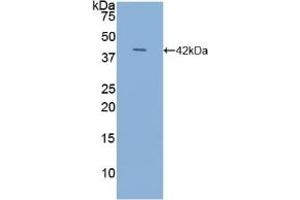 Detection of Recombinant NT-ProANP, Human using Polyclonal Antibody to N-Terminal Pro-Atrial Natriuretic Peptide (NT-ProANP) (PRO-ANP anticorps  (AA 25-123))