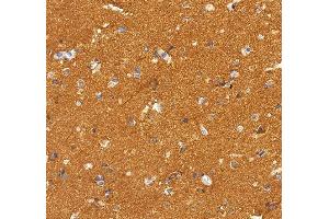 IHC analysis of NSF using anti-NSF antibody (ABIN7601630).