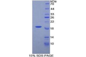 Rabbit Detection antibody from the kit in WB with Positive Control:  Sample Human 293T Cells.
