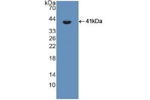 Detection of Recombinant CSPG5, Rat using Polyclonal Antibody to Chondroitin Sulfate Proteoglycan 5 (CSPG5) (CSPG5 anticorps  (AA 139-370))
