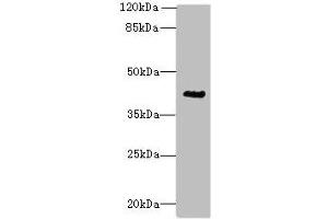 Western blot All lanes: ACTG2 antibody at 3 μg/mL + CEM whole cell lysate Secondary Goat polyclonal to rabbit IgG at 1/10000 dilution Predicted band size: 42, 38 kDa Observed band size: 42 kDa