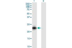 Western Blot analysis of RRAS2 expression in transfected 293T cell line by RRAS2 monoclonal antibody (M01), clone 2D3-4B8.