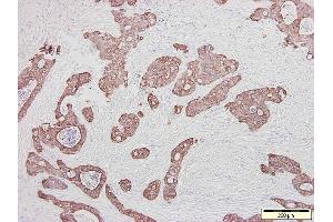 anti-Keratin 20 (KRT20) antibody