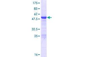 Image no. 1 for Immunoglobulin lambda Constant 2 (Kern-Oz- Marker) (IGLC2) (AA 1-235) protein (GST tag) (ABIN1307603) (IGLC2 Protein (AA 1-235) (GST tag))