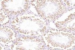 Immunohistochemistry analysis of paraffin-embedded rat testis using,TTC12 (ABIN7075869) at dilution of 1: 4400 (TTC12 anticorps)