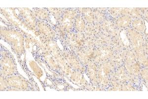 Detection of MMP2 in Human Kidney Tissue using Monoclonal Antibody to Matrix Metalloproteinase 2 (MMP2)