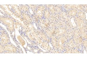 Detection of MMP2 in Human Kidney Tissue using Monoclonal Antibody to Matrix Metalloproteinase 2 (MMP2) (MMP2 anticorps  (AA 110-660))