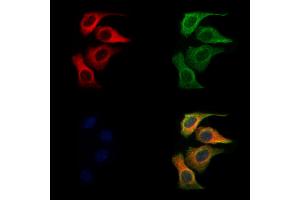 ABIN6261572 and ABIN6272293 staining Hela cells by IF/ICC.