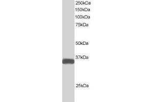 ABIN184938 (1µg/ml) staining of Human Heart lysate (35µg protein in RIPA buffer).