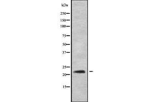 Western blot analysis of RAB22A using HT29 whole cell lysates (RAB22A anticorps  (C-Term))