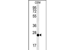CRISPLD2 Antibody (N-term) (ABIN651759 and ABIN2840390) western blot analysis in CEM cell line lysates (15 μg/lane).