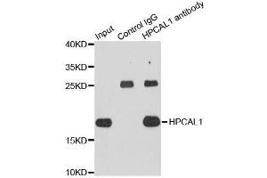Immunoprecipitation analysis of extracts of HepG2 cells using HPCAL1 antibody.