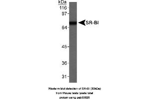 Image no. 1 for anti-Scavenger Receptor Class B, Member 1 (SCARB1) antibody (ABIN363335) (SCARB1 anticorps)