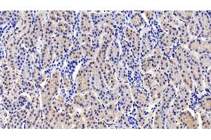 Detection of RPS6Kb1 in Porcine Kidney Tissue using Polyclonal Antibody to Ribosomal Protein S6 Kinase Beta 1 (RPS6Kb1)