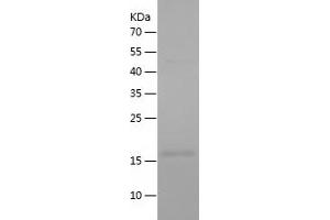 Western Blotting (WB) image for Caspase 8 (CASP8) (AA 217-374) protein (His tag) (ABIN7122169)